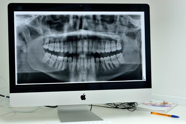 Dr Vincent Decrocq, chirurgien dentiste &agrave; Colmar