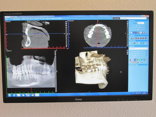 Dr Vincent Decrocq, chirurgien dentiste &agrave; Colmar