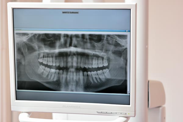 Dr Vincent Decrocq, chirurgien dentiste &agrave; Colmar